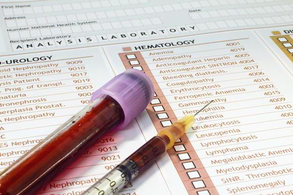 Analyse für Cytomegalovirus: Hinweise für die Ernennung von Bluttests, die Decodierung zeigt